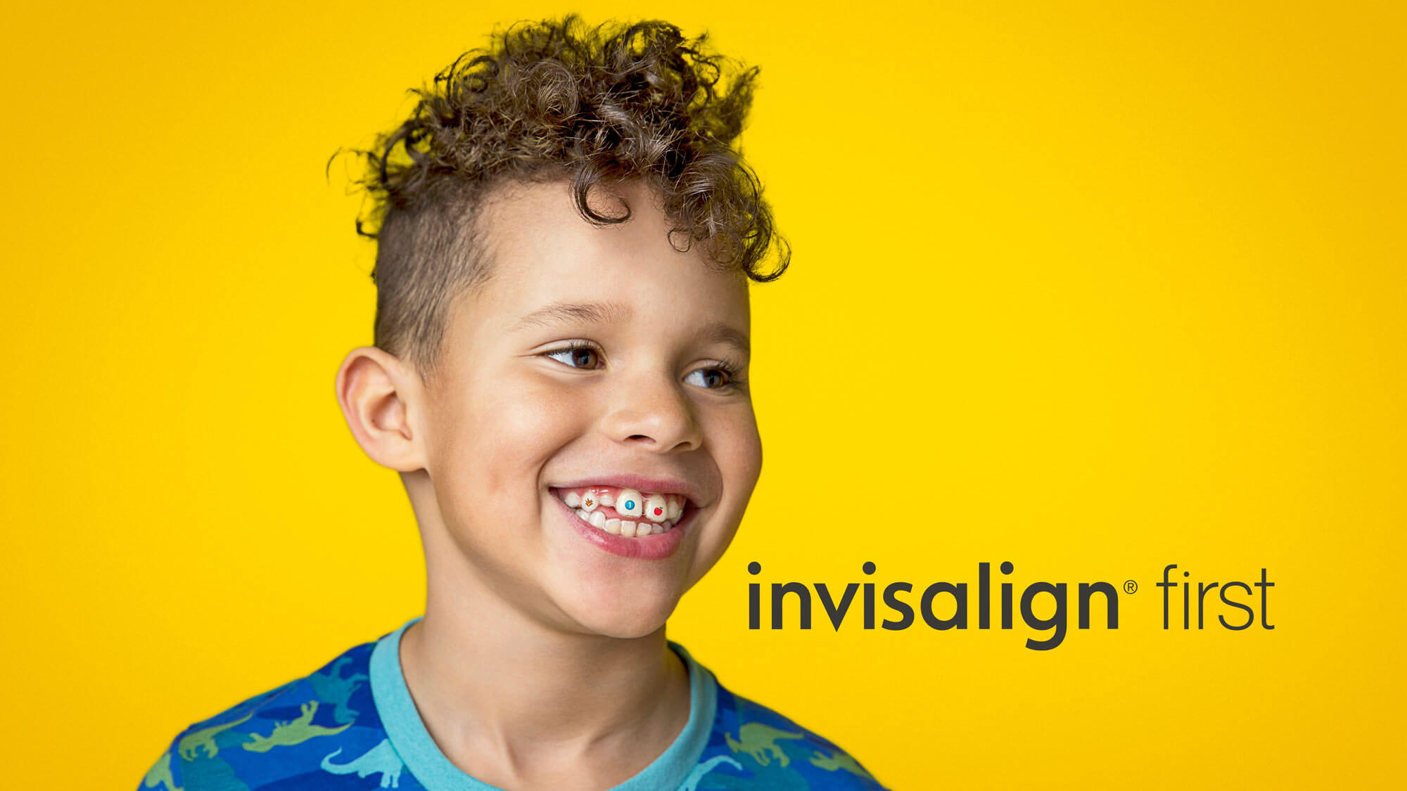 Invisalign First for Kids  Rogers & Andrews Orthodontics