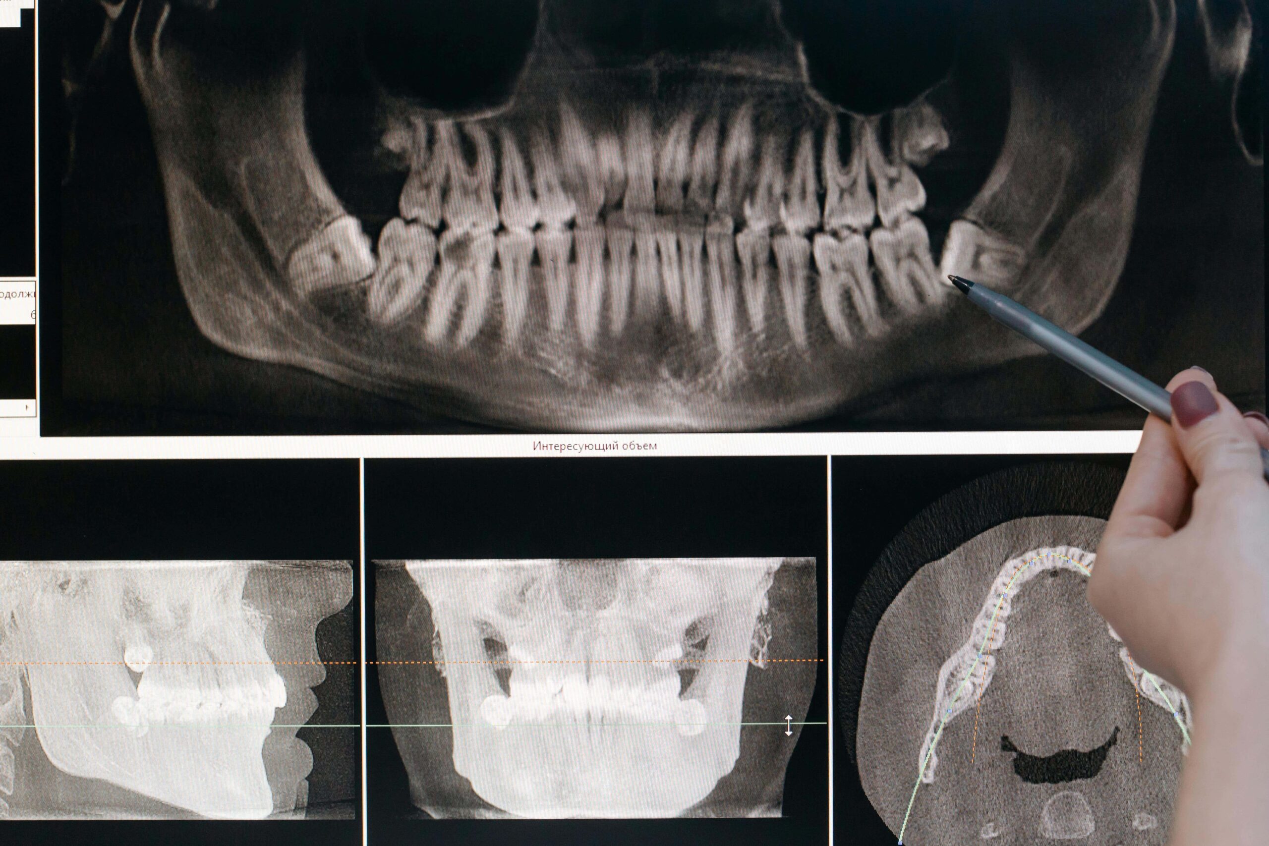 orthodontic scan